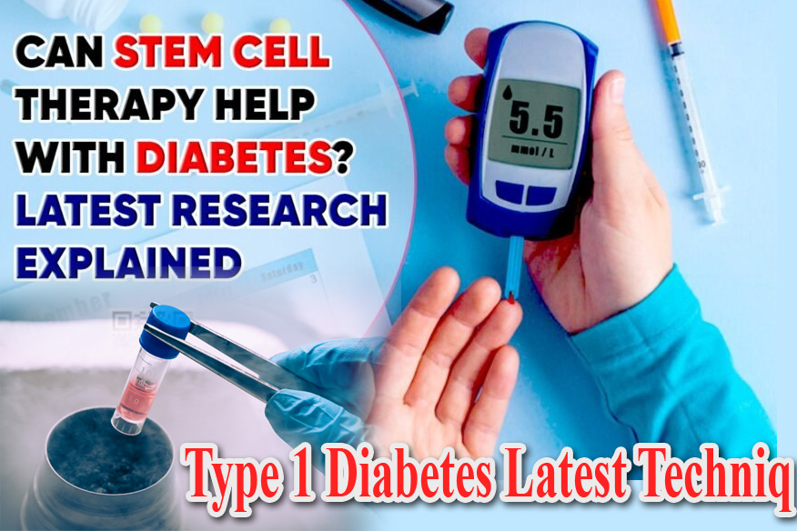Diabetes Stem Cell Therapy